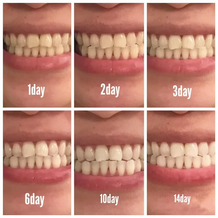 1695730920738297.png d5f097c5dff936ade7d12444dff7ea7.png