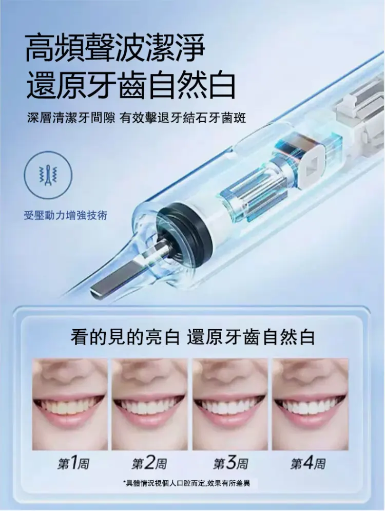 破萬口碑一致好評的電動牙刷, 採用最新科技,高頻振動 + 持久續航+ 護牙刷毛 震動高達42000次! 清潔力加倍但溫和不傷牙牙 破萬口碑一致好評的電動牙刷, 採用最新科技,高頻振動 + 持久續航+ 護牙刷毛 震動高達42000次! 清潔力加倍但溫和不傷牙牙