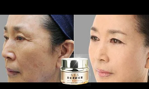 1701149366127133.png 80e780c3da415a8f48d1dec4d1f94c2.png